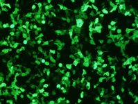 ACHN Cell Avalanche® Transfection Reagent (human kidney adenocarcinoma cell) product image