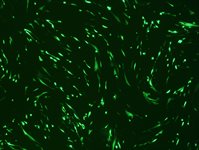 Human Cardiac Fibroblasts (HCF, NHCF-A, NHCF-V, AoAF) Avalanche™ Transfection Reagent product image