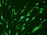 Human Fibroblast-Like Synoviocyte (HFLS, HFLS-OA, HFLS-RA) Avalanche™ Transfection Reagent product image