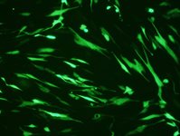 Human Lung Fibroblast (HLF, NHLF) Avalanche™ Transfection Reagent product image