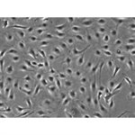 Human Lung Microvascular Endothelial Cell (HLMVEC, HMVEC-L) Avalanche™ Transfection Reagent product image