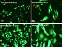 Human Umbilical Vein Endothelial Cell (HUVEC) Avalanche™ Transfection Reagent product image