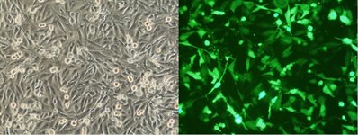 U251 Cell Avalanche® Transfection Reagent (human glioblastoma cell product image