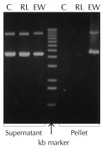 Figure 1. Lysis with Ready-Lyse Lysozyme increases yields of nucleic acids.
