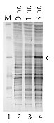 Figure 2. Use of Ready-Lyse Lysozyme Solution to recover recombinant proteins.